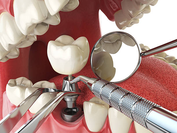 Best Emergency Dental Care for Trauma or Injury in East Cleveland, OH